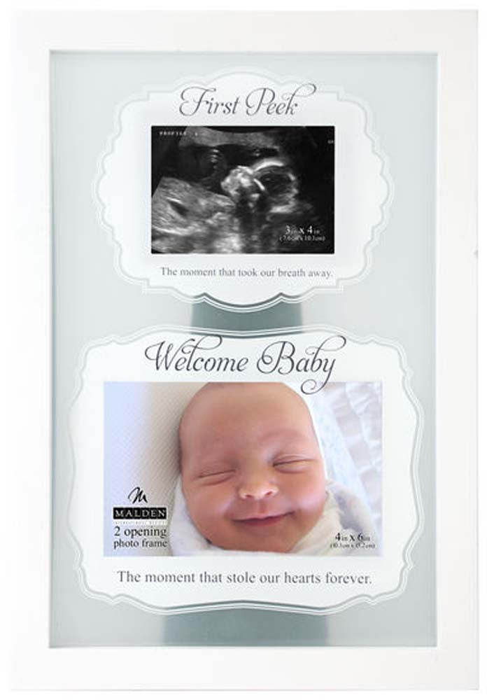 Malden 2 opening first peek sonogram frame